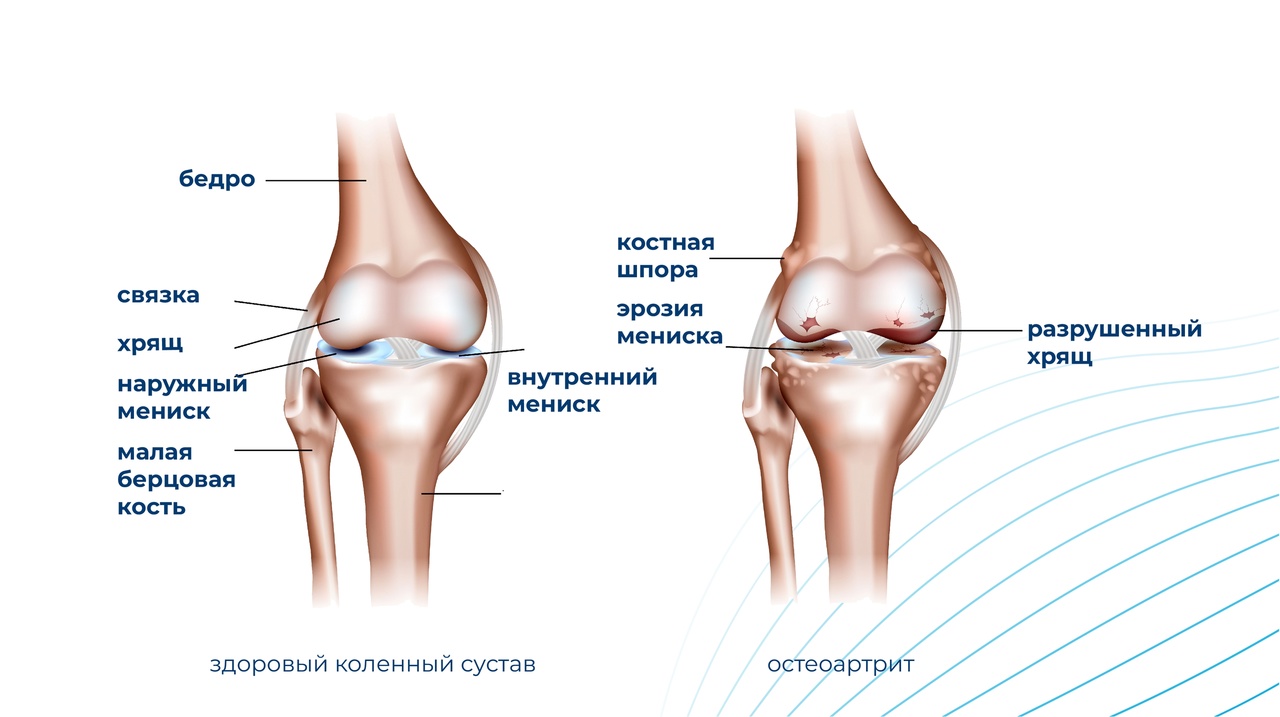 Если больно преклонять колени